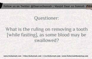 Can he Remove a Tooth while Fasting? – Shaykh Muqbil