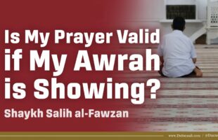 Is My Prayer Valid if My Awrah is Showing? | Shaykh Salih al-Fawzan