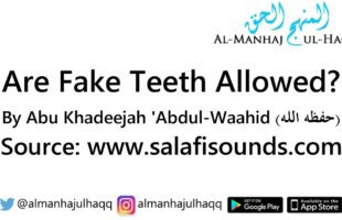 Are Fake Teeth Allowed? – By Abu Khadeejah ‘Abdul-Waahid